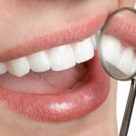 Are There Dental Insurance With No Waiting Period Available?